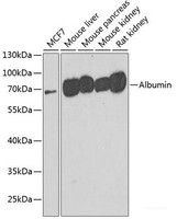 Western blot analysis of extracts of various cell lines using Albumin Polyclonal Antibody at dilution of 1:500.