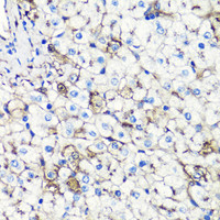 Immunohistochemistry of paraffin-embedded Human liver using Albumin Polyclonal Antibody at dilution of 1:100 (40x lens) .