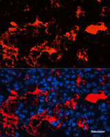 Immunofluorescence analysis of Human liver cancer cells using Albumin Polyclonal Antibody at dilution of 1:100. Blue: DAPI for nuclear staining.