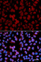 Immunofluorescence analysis of U2OS cells using TNFAIP3 Polyclonal Antibody