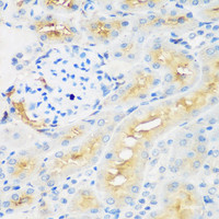 Immunohistochemistry of paraffin-embedded Rat kidney using PROCR Polyclonal Antibody at dilution of 1:200 (40x lens) .