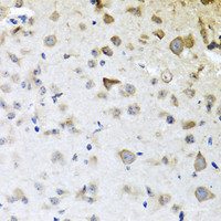 Immunohistochemistry of paraffin-embedded Mouse brain using CPA6 Polyclonal Antibody at dilution of 1:100 (40x lens) .
