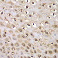 Immunohistochemistry of paraffin-embedded Human esophagus using INTS5 Polyclonal Antibody at dilution of 1:100 (40x lens) .