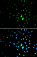 Immunofluorescence analysis of MCF-7 cells using PIN1 Polyclonal Antibody