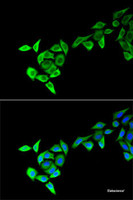 Immunofluorescence analysis of HeLa cells using MECOM Polyclonal Antibody