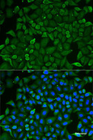 Immunofluorescence analysis of U2OS cells using CARS Polyclonal Antibody