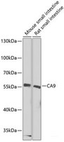 Western blot analysis of extracts of various cell lines using CA9 Polyclonal Antibody at dilution of 1:1000.