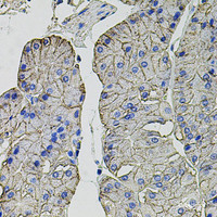 Immunohistochemistry of paraffin-embedded Human stomach using CA9 Polyclonal Antibody at dilution of 1:100 (40x lens) .