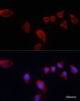 Immunofluorescence analysis of HeLa cells using CA9 Polyclonal Antibody at dilution of 1:100. Blue: DAPI for nuclear staining.