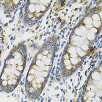 Immunohistochemistry of paraffin-embedded Human colon using DEFB132 Polyclonal Antibody at dilution of 1:100 (40x lens) .
