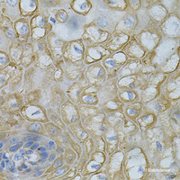 Immunohistochemistry of paraffin-embedded Human esophagus using DEFB132 Polyclonal Antibody at dilution of 1:100 (40x lens) .