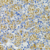 Immunohistochemistry of paraffin-embedded Mouse kidney using DEFB132 Polyclonal Antibody at dilution of 1:100 (40x lens) .