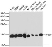 Western blot analysis of extracts of various cell lines using RPL30 Polyclonal Antibody at dilution of 1:3000.