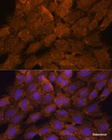 Immunofluorescence analysis of C6 cells using TNFAIP8L2 Polyclonal Antibody at dilution of 1:100. Blue: DAPI for nuclear staining.