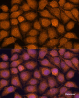 Immunofluorescence analysis of HeLa cells using TNFAIP8L2 Polyclonal Antibody at dilution of 1:100. Blue: DAPI for nuclear staining.