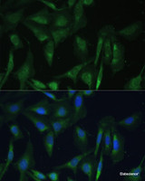 Immunofluorescence analysis of U-2 OS cells using CAMLG Polyclonal Antibody at dilution of 1:100 (40x lens) . Blue: DAPI for nuclear staining.