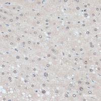 Immunohistochemistry of paraffin-embedded Human liver using ZNF707 Polyclonal Antibody at dilution of 1:100 (40x lens) .