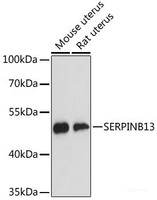 Western blot analysis of extracts of various cell lines using SERPINB13 Polyclonal Antibody at dilution of 1:3000.