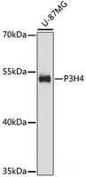 Western blot analysis of extracts of U-87MG cells using P3H4 Polyclonal Antibody at dilution of 1:3000.