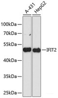 Western blot analysis of extracts of various cell lines using IFIT2 Polyclonal Antibody at dilution of 1:3000.