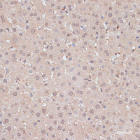 Immunohistochemistry of paraffin-embedded Rat liver using HSF1 Polyclonal Antibody at dilution of 1:100 (40x lens) .