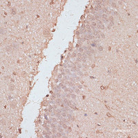 Immunohistochemistry of paraffin-embedded Rat brain using HSF1 Polyclonal Antibody at dilution of 1:100 (40x lens) .