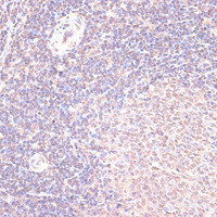 Immunohistochemistry of paraffin-embedded Rat spleen using HSF1 Polyclonal Antibody at dilution of 1:100 (40x lens) .