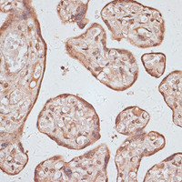 Immunohistochemistry of paraffin-embedded Human placenta using HSF1 Polyclonal Antibody at dilution of 1:100 (40x lens) .
