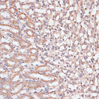 Immunohistochemistry of paraffin-embedded Mouse kidney using HSF1 Polyclonal Antibody at dilution of 1:100 (40x lens) .