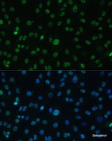 Immunofluorescence analysis of C6 cells using HSF1 Polyclonal Antibody at dilution of 1:100. Blue: DAPI for nuclear staining.