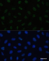 Immunofluorescence analysis of U2OS cells using HSF1 Polyclonal Antibody at dilution of 1:100. Blue: DAPI for nuclear staining.