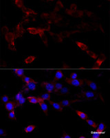 Immunofluorescence analysis of NIH/3T3 cells using CYP1B1 Polyclonal Antibody at dilution of 1:100 (40x lens) . Blue: DAPI for nuclear staining.