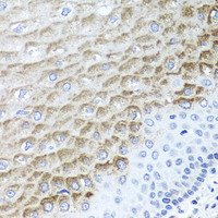 Immunohistochemistry of paraffin-embedded Human esophagus using F3 Polyclonal Antibody at dilution of 1:100 (40x lens) .