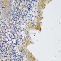 Immunohistochemistry of paraffin-embedded Human appendix using GCC2 Polyclonal Antibody at dilution of 1:150 (40x lens) .