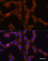 Immunofluorescence analysis of C6 cells using GANAB Polyclonal Antibody at dilution of 1:100. Blue: DAPI for nuclear staining.