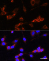 Immunofluorescence analysis of NIH-3T3 cells using GANAB Polyclonal Antibody at dilution of 1:100. Blue: DAPI for nuclear staining.