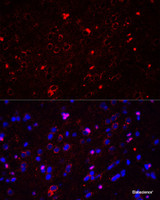 Immunofluorescence analysis of Rat brain using GRIN2A Polyclonal Antibody at dilution of 1:50. Blue: DAPI for nuclear staining.