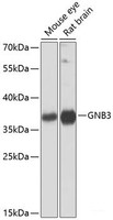 Western blot analysis of extracts of various cell lines using GNB3 Polyclonal Antibody at dilution of 1:1000.