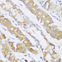 Immunohistochemistry of paraffin-embedded Human stomach using FA2H Polyclonal Antibody at dilution of 1:150 (40x lens) .