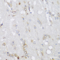 Immunohistochemistry of paraffin-embedded Rat brain using FA2H Polyclonal Antibody at dilution of 1:150 (40x lens) .
