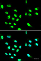 Immunofluorescence analysis of HepG2 cells using FCGR2A Polyclonal Antibody