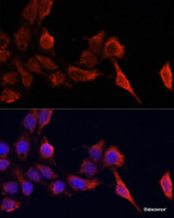 Immunofluorescence analysis of HeLa cells using TIMP1 Polyclonal Antibody at dilution of 1:100. Blue: DAPI for nuclear staining.