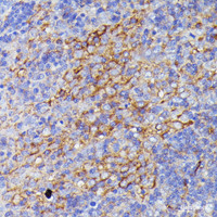 Immunohistochemistry of paraffin-embedded Rat lymph node using SNAP23 Polyclonal Antibody at dilution of 1:100 (40x lens) .