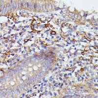 Immunohistochemistry of paraffin-embedded Human appendix using SNAP23 Polyclonal Antibody at dilution of 1:100 (40x lens) .