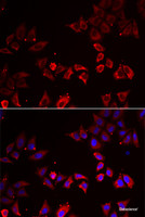 Immunofluorescence analysis of A549 cells using LIMS1 Polyclonal Antibody