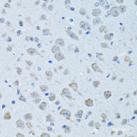 Immunohistochemistry of paraffin-embedded Rat brain using KNG1 Polyclonal Antibody at dilution of 1:100 (40x lens) .