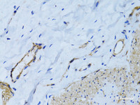 Immunohistochemistry of paraffin-embedded Human colon using MCAM Polyclonal Antibody at dilution of 1:100 (40x lens) .