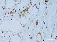 Immunohistochemistry of paraffin-embedded Human breast using MCAM Polyclonal Antibody at dilution of 1:100 (40x lens) .