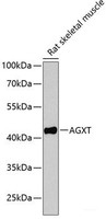 Western blot analysis of extracts of Rat skeletal muscle using AGXT Polyclonal Antibody at dilution of 1:1000.