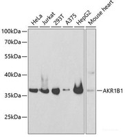 Western blot analysis of extracts of various cell lines using AKR1B1 Polyclonal Antibody at dilution of 1:1000.